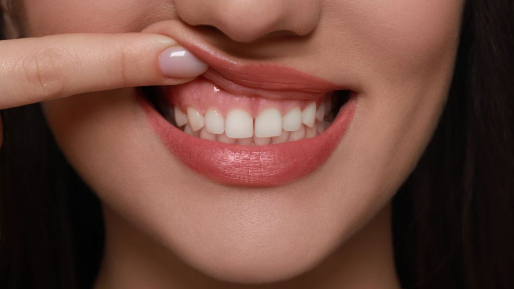 gum disease treatment